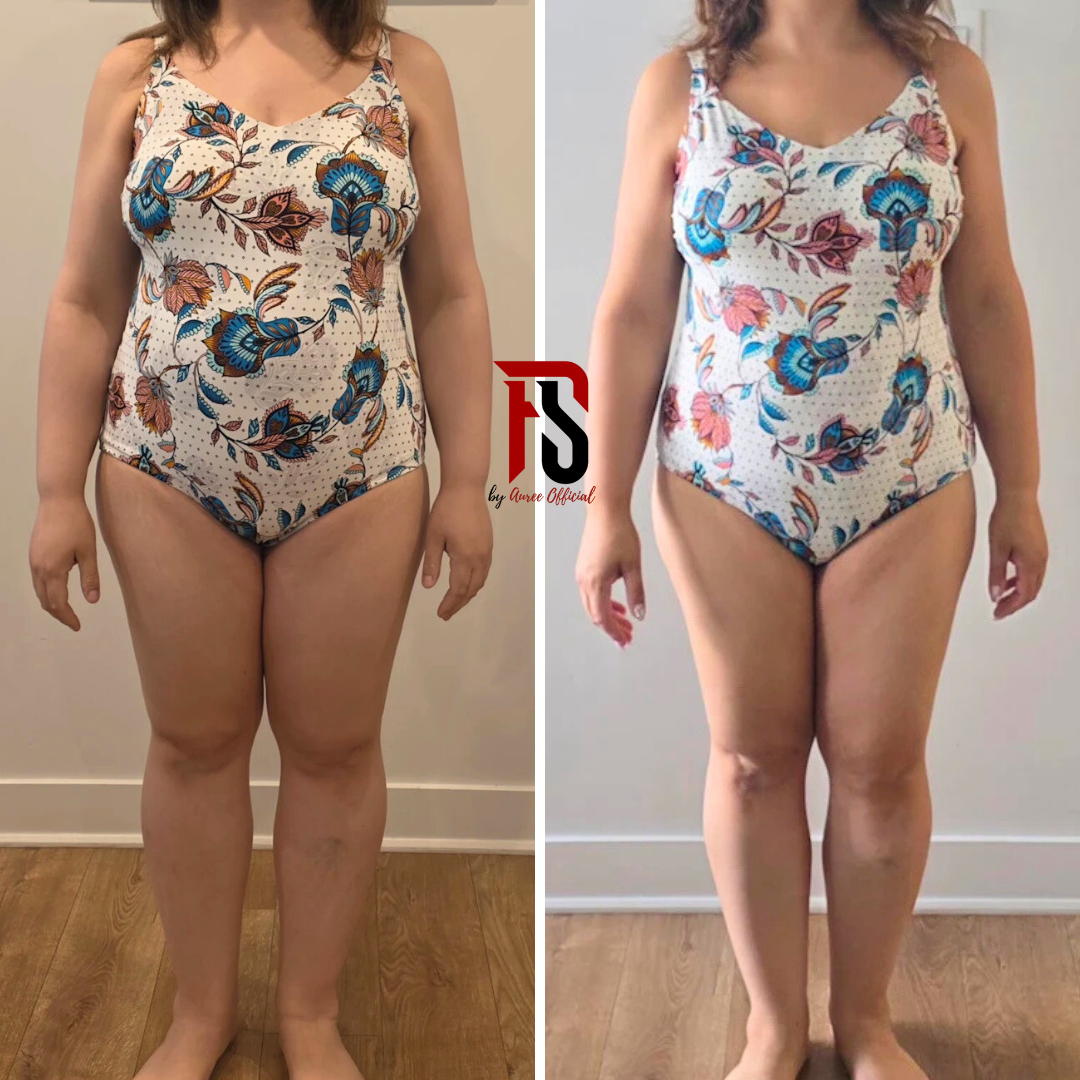 Transformation avant après de face pour Lydia