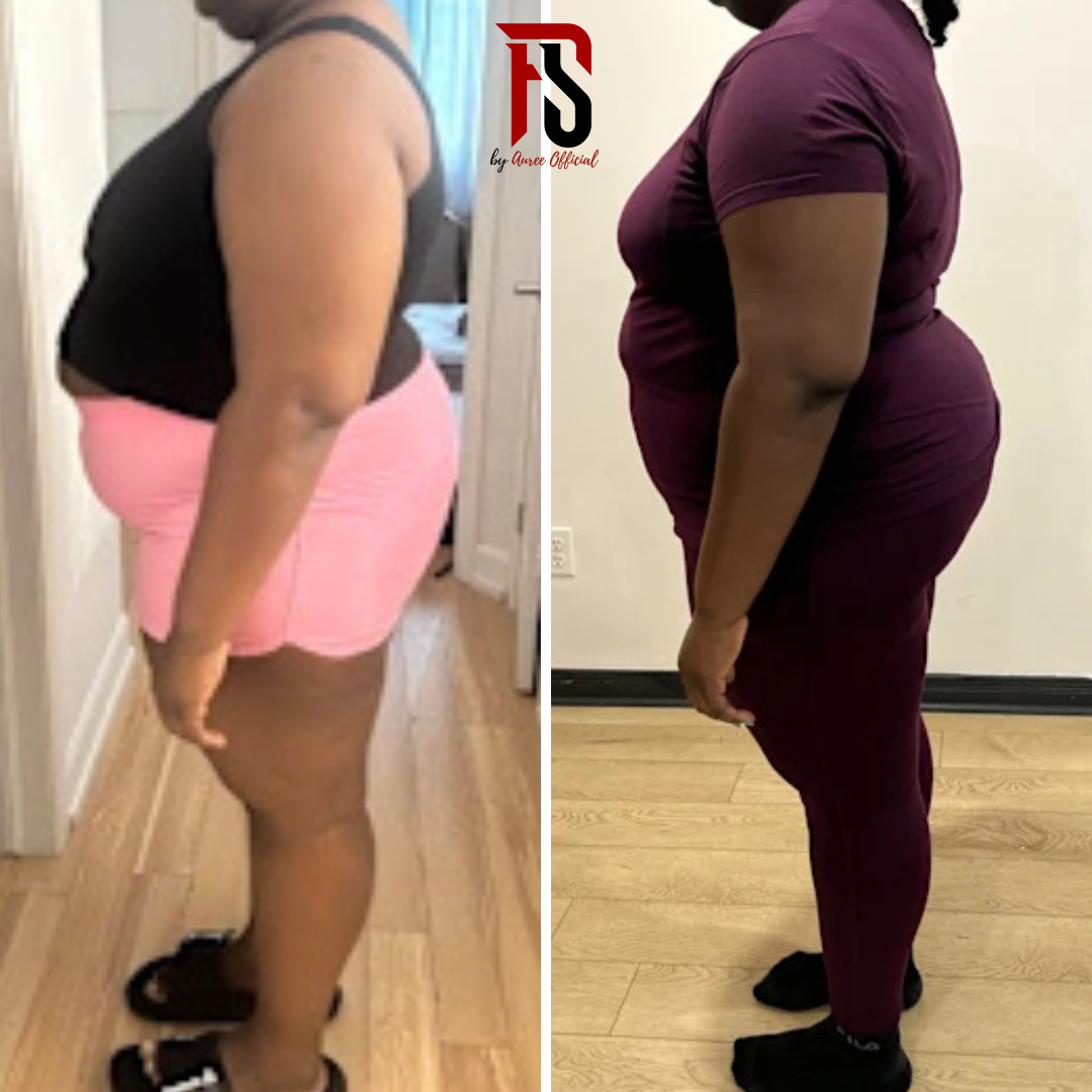 Transformation avant après de profil